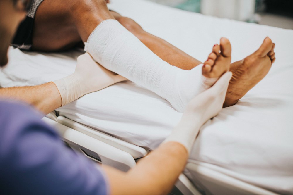 Fracture and trauma care at ARKA Clinic